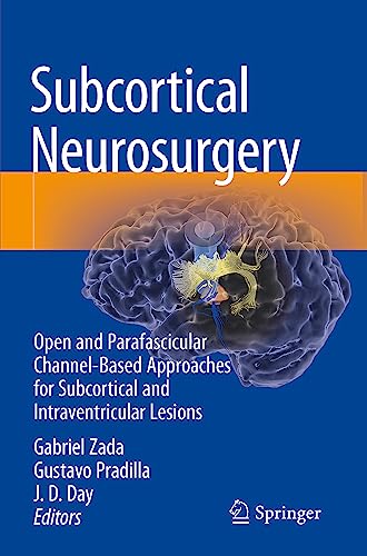 Subcortical Neurosurgery: Open and Parafascicular Channel-Based Approaches for Subcortical and Intraventricular Lesions