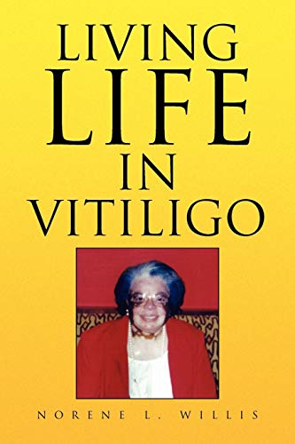 Living Life In Vitiligo