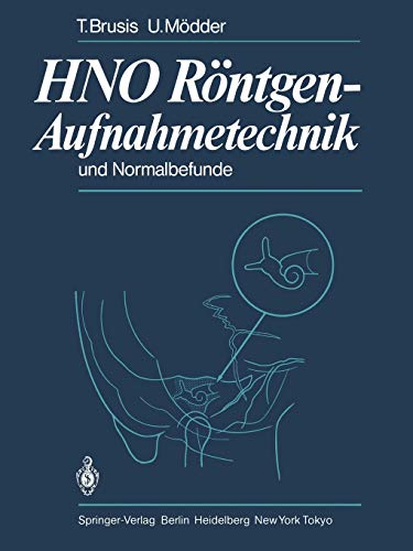 H.N.O. Röntgen-Aufnahmetechnik und Normalbefunde (German Edition)