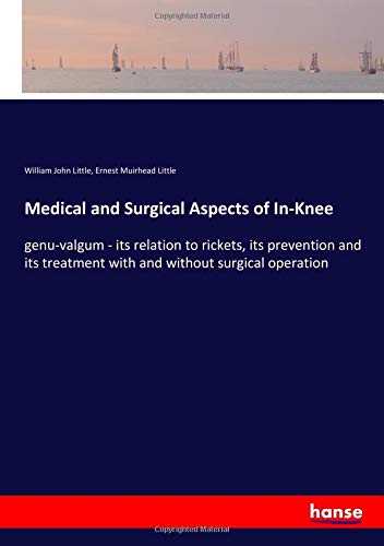Medical and Surgical Aspects of In-Knee: genu-valgum - its relation to rickets, its prevention and its treatment with and without surgical operation