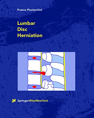 Lumbar Disc Herniation: Foreword by James N. Weinstein