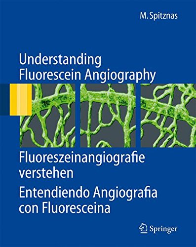 Understanding Fluorescein Angiography, Fluoreszeinangiografie verstehen, Entendiendo Angiografía con Fluoresceína: Fluoreszeinangiografie Verstehen, Entendiendo Angiografia Con Fluoresceina