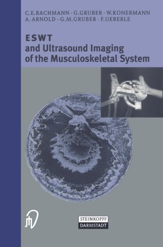 ESWT and Ultrasound Imaging of the Musculoskeletal System