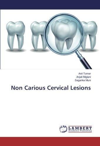 Non Carious Cervical Lesions