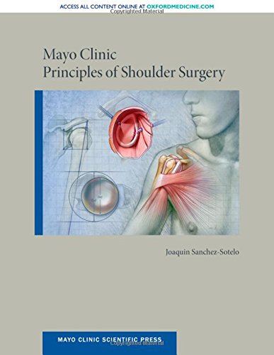 Sanchez-Sotelo, J: Mayo Clinic Principles of Shoulder Surger (Mayo Clinic Scientific Press)