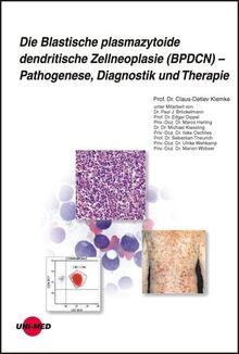 Die Blastische plasmazytoide dendritische Zellneoplasie (BPDCN) – Pathogenese, Diagnostik und Therapie (UNI-MED Science)