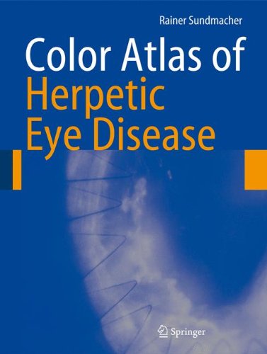 Color Atlas of Herpetic Eye Disease: A Practical Guide to Clinical Management