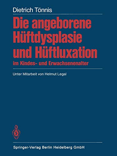 Die angeborene Hüftdysplasie und Hüftluxation im Kindes- und Erwachsenenalter: Grundlagen, Diagnostik, konservative und operative Behandlung