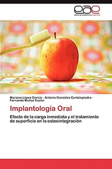 Implantología Oral: Efecto de la carga inmediata y el tratamiento de superficie en la osteointegración