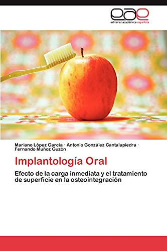 Implantología Oral: Efecto de la carga inmediata y el tratamiento de superficie en la osteointegración