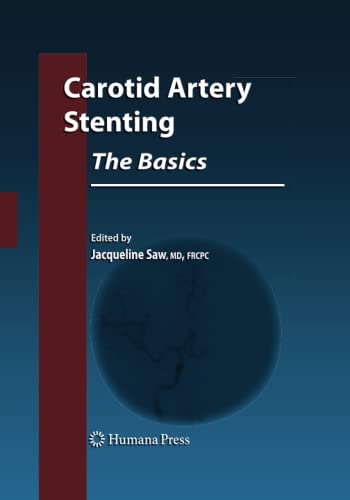 Carotid Artery Stenting: The Basics (Contemporary Cardiology)
