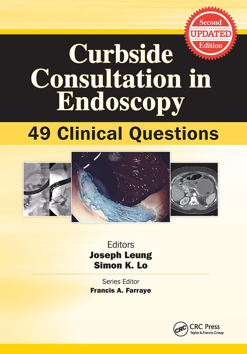 Curbside Consultation in Endoscopy: 49 Clinical Questions (Curbside Consultation in Gastroenterology)