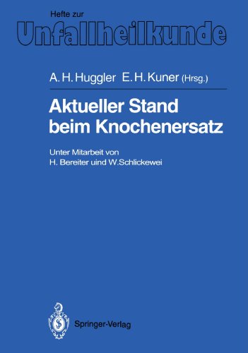 Aktueller Stand Beim Knochenersatz (Hefte zur Zeitschrift Der Unfallchirurg) (German Edition)