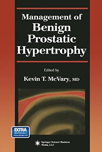 Management of Benign Prostatic Hypertrophy (Current Clinical Urology)