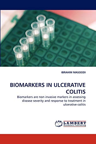 BIOMARKERS IN ULCERATIVE COLITIS: Biomarkers are non invasive markers in assessing disease severity and response to treatment in ulcerative colitis
