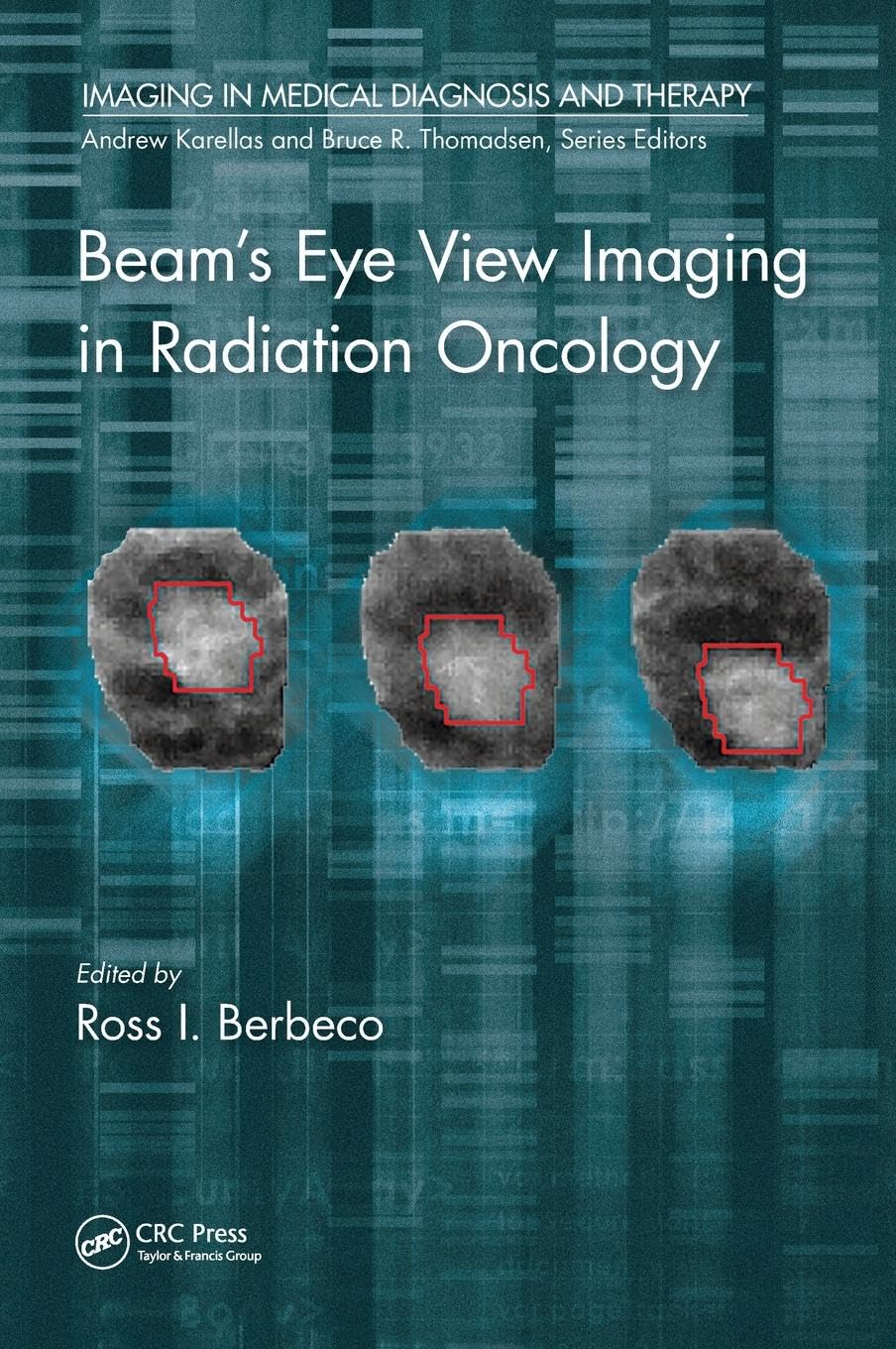 Beam's Eye View Imaging in Radiation Oncology (Imaging in Medical Diagnosis and Therapy)