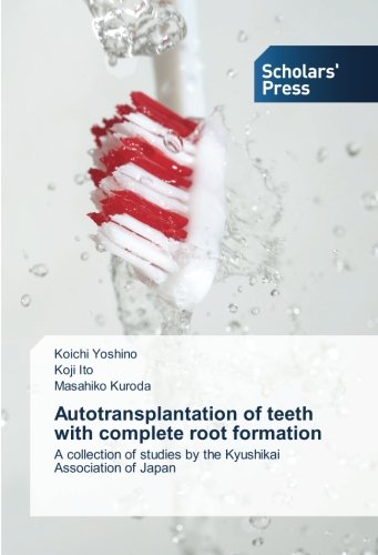Autotransplantation of teeth with complete root formation: A collection of studies by the Kyushikai Association of Japan
