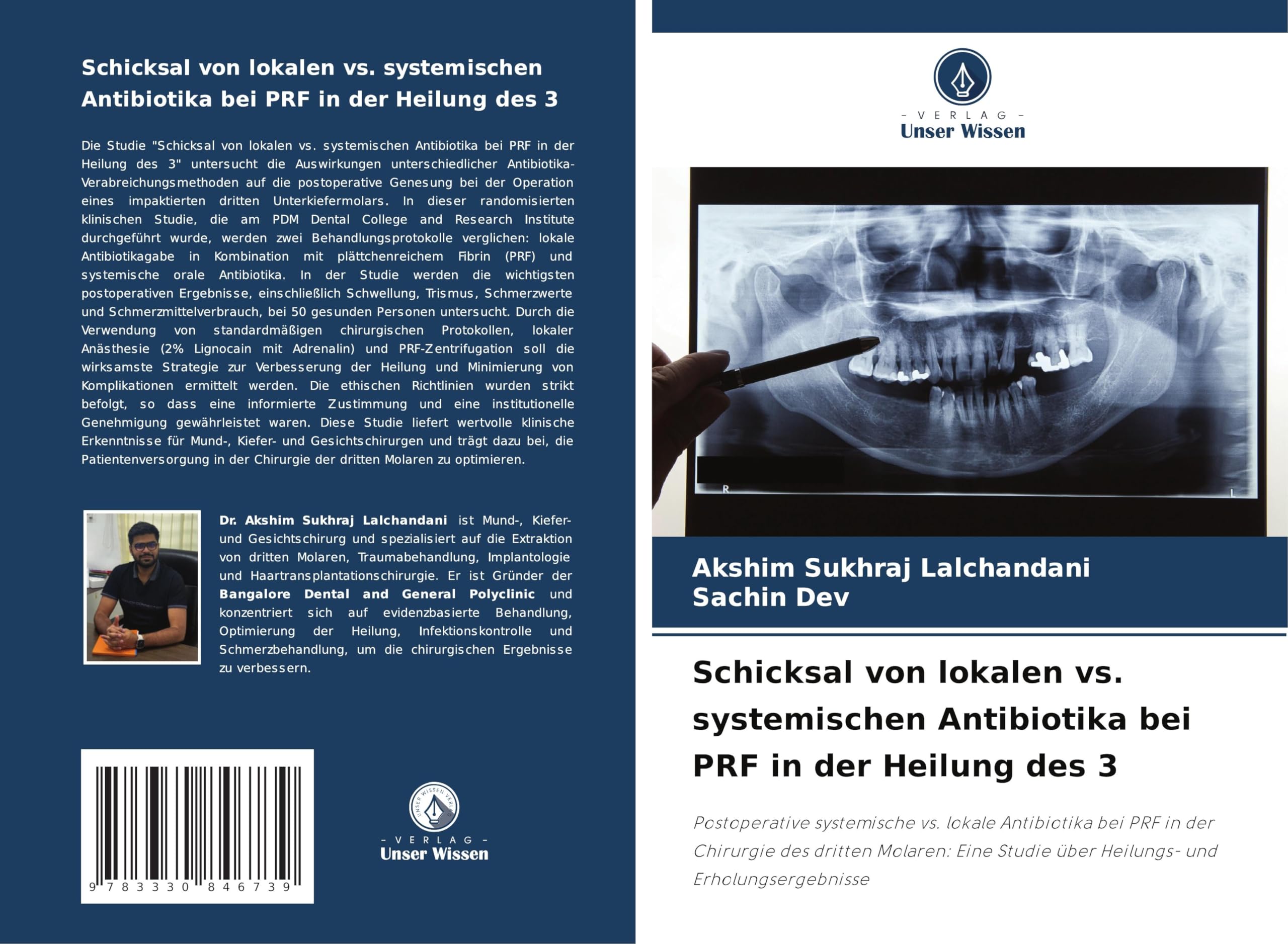 Schicksal von lokalen vs. systemischen Antibiotika bei PRF in der Heilung des 3: Postoperative systemische vs. lokale Antibiotika bei PRF in der ... Studie über Heilungs- und Erholungsergebnisse