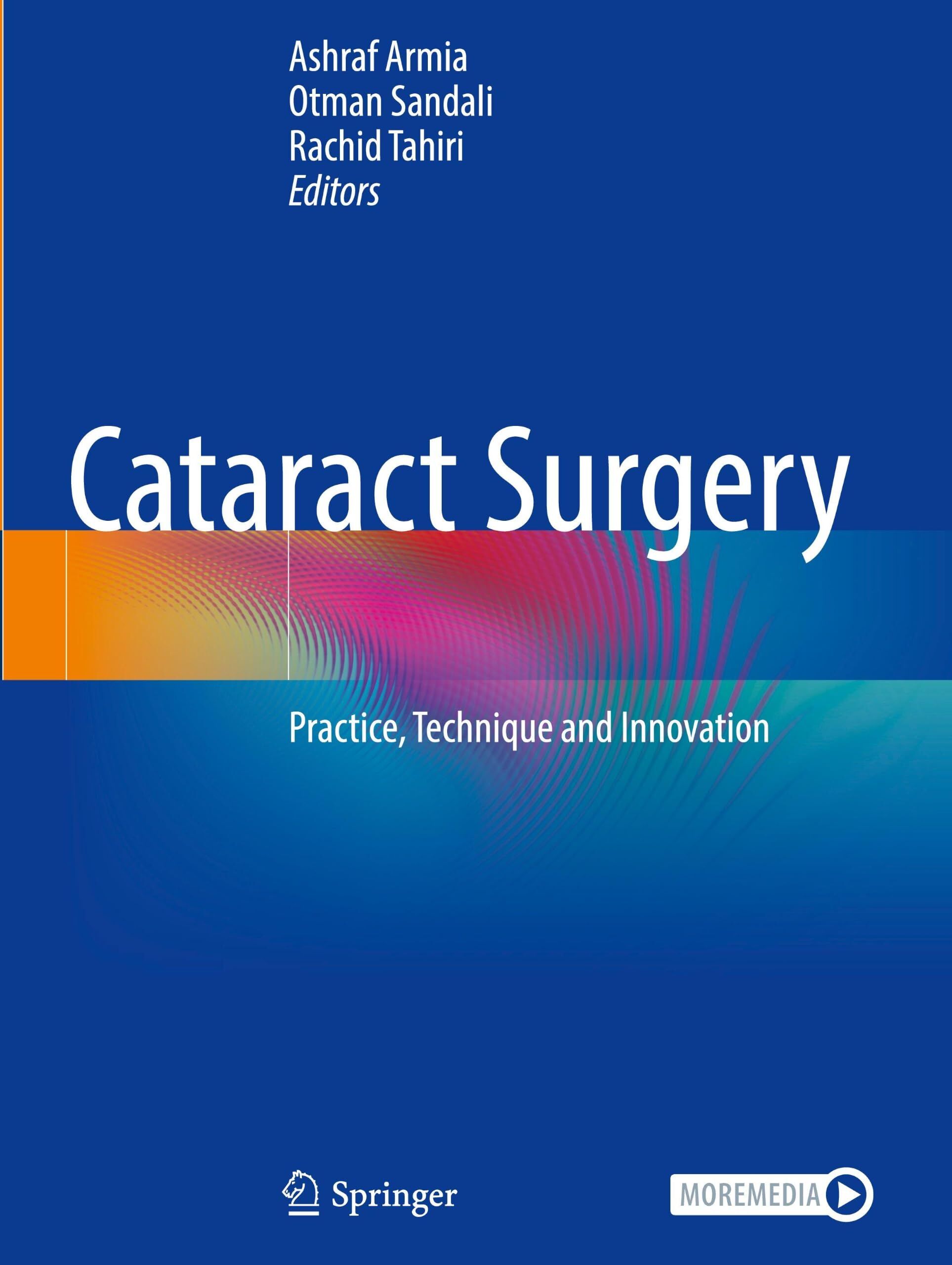 Cataract Surgery