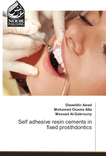 Self adhesive resin cements in fixed prosthdontics
