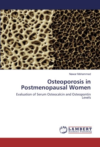 Osteoporosis in Postmenopausal Women: Evaluation of Serum Osteocalcin and Osteopontin Levels