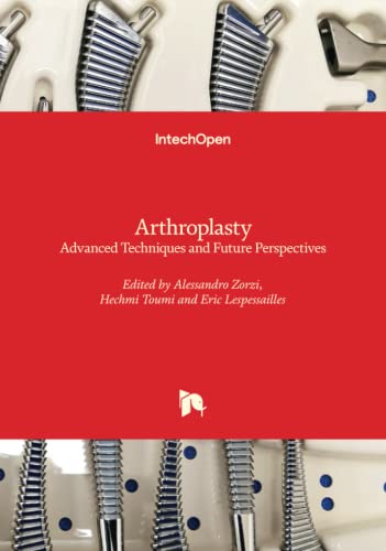 Arthroplasty - Advanced Techniques and Future Perspectives