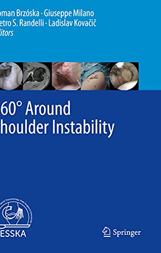 360° Around Shoulder Instability