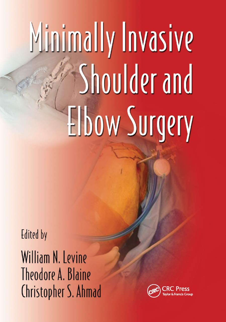 Minimally Invasive Shoulder and Elbow Surgery (Minimally Invasive Procedures in Orthopedic Surgery, Band 1)