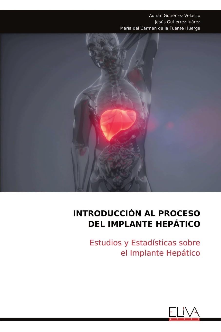 INTRODUCCIÓN AL PROCESO DEL IMPLANTE HEPÁTICO: Estudios y Estadísticas sobre el Implante Hepático