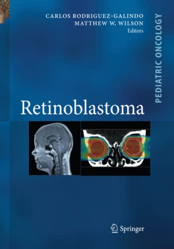 Retinoblastoma (Pediatric Oncology)