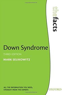 Down Syndrome (The Facts)