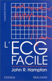 L'ECG facile