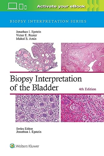 Epstein, Jonathan I. Biopsy Interpretation Of The Bladder