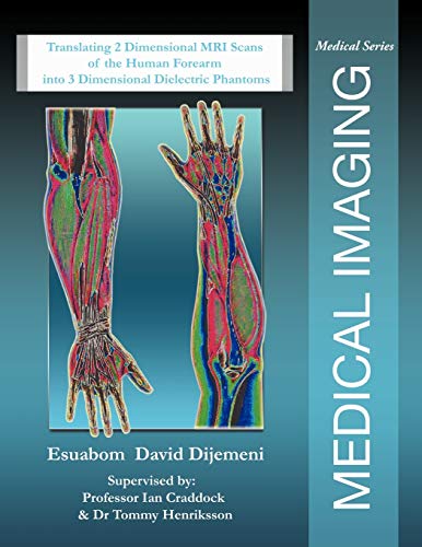 Medical Imaging: Translating 2 Dimensional MRI Scans of the Human Forearm into 3 Dimensional Dielectric Phantoms