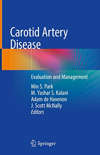 Carotid Artery Disease: Evaluation and Management