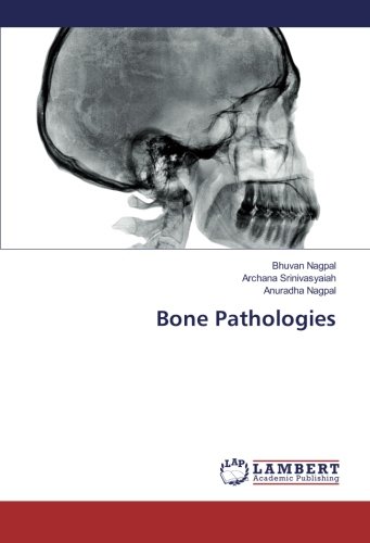 Bone Pathologies