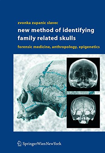 New Method of Identifying Family Related Skulls: Forensic Medicine, Anthropology, Epigenetics