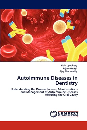 Autoimmune Diseases in Dentistry: Understanding the Disease Process, Manifestations and Management of Autoimmune Diseases Affecting the Oral Cavity