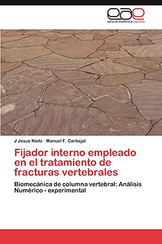 Fijador interno empleado en el tratamiento de fracturas vertebrales: Biomecánica de columna vertebral: Análisis Numérico - experimental