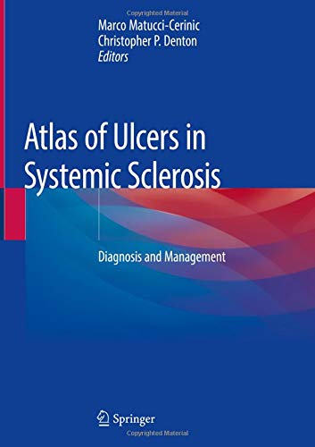 Atlas of Ulcers in Systemic Sclerosis: Diagnosis and Management