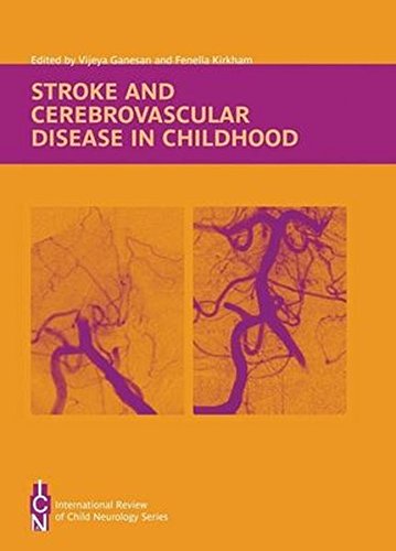 International Review of Child Neurology: Stroke and Cerebrovascular Disease in Childhood