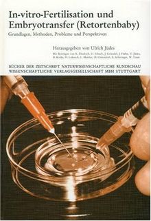 In-vitro- Fertilisation und Embryotransfer ( Retortenbaby). Grundlagen, Methoden, Probleme und Perspektiven