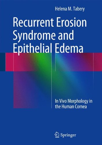 Recurrent Erosion Syndrome and Epithelial Edema: In Vivo Morphology in the Human Cornea
