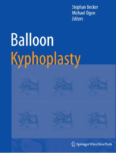 Balloon Kyphoplasty