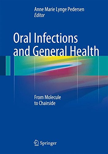 Oral Infections and General Health: From Molecule to Chairside