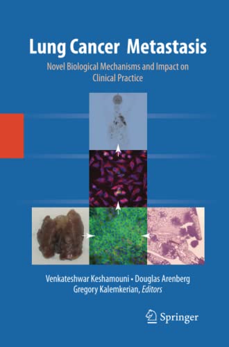 Lung Cancer Metastasis: Novel Biological Mechanisms and Impact on Clinical Practice