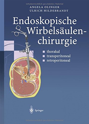 Endoskopische Wirbelsäulenchirurgie: Thorakal · Transperitoneal · Retroperitoneal (German Edition)