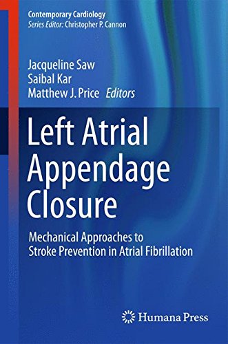 Left Atrial Appendage Closure: Mechanical Approaches to Stroke Prevention in Atrial Fibrillation (Contemporary Cardiology)