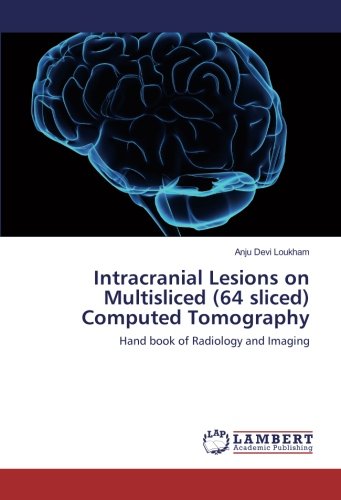 Intracranial Lesions on Multisliced (64 sliced) Computed Tomography: Hand book of Radiology and Imaging