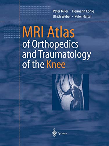 Mri Atlas of Orthopedics and Traumatology of the Knee